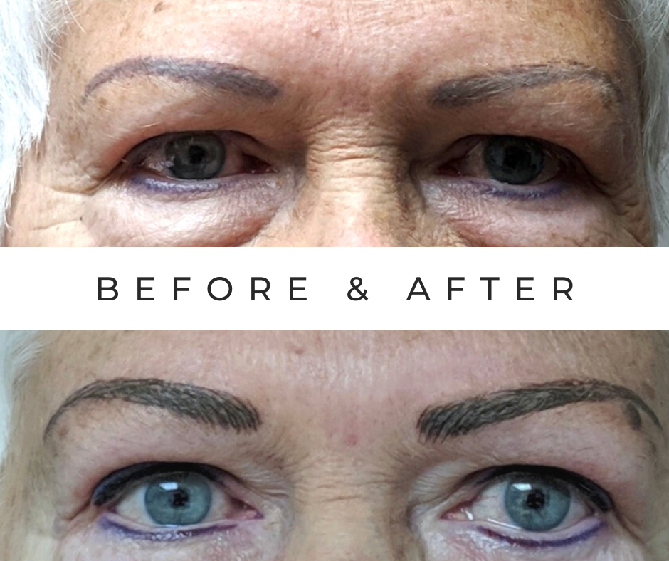 Luxury Marble Before and After Facebook Post (3).png