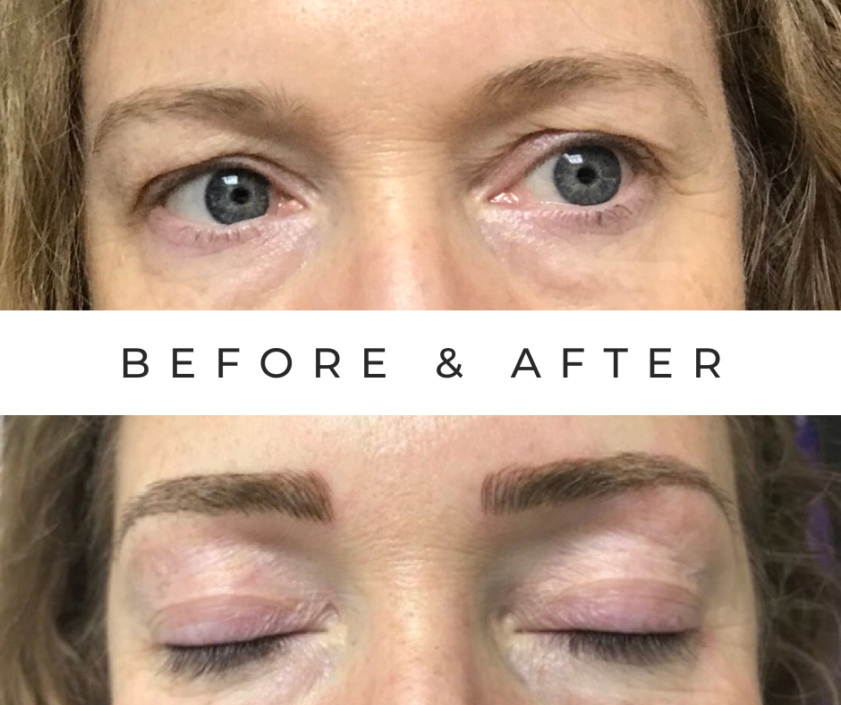 Luxury Marble Before and After Facebook Post (9).png