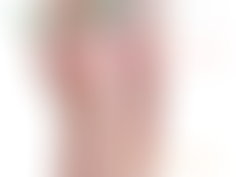 Why the Outside of Your Hip Hurts: Understanding GTPS