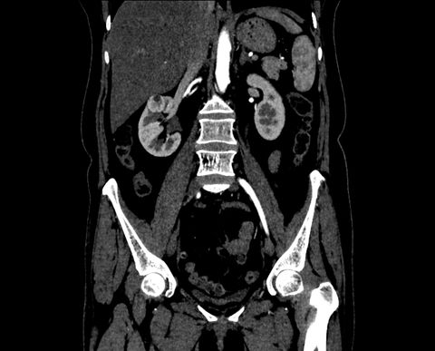Medical Image classification using MLflow DVC