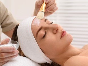  The Magic of Chemical Peels: Revealing Your Smoothest Skin Ever