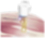 cold-laser-therapy-calgary