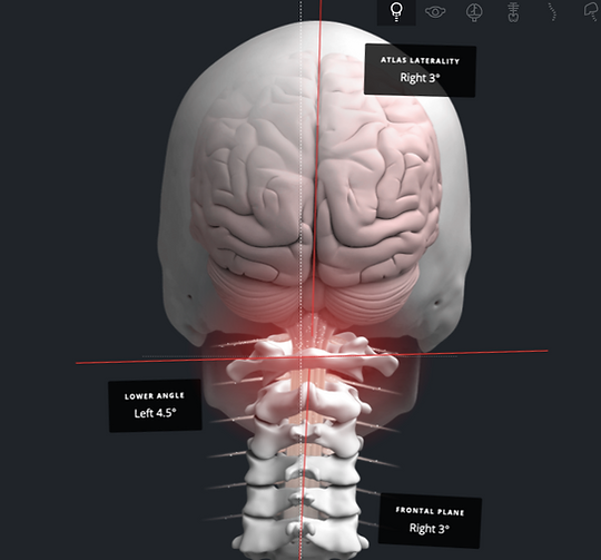 brain-image-nucca-chiropractic