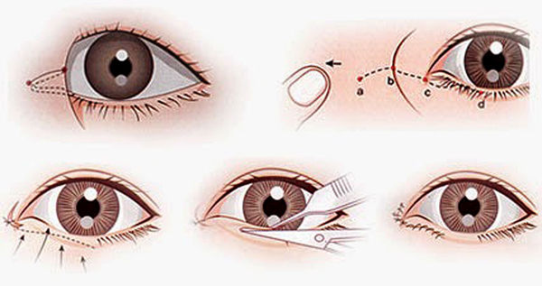 Làm mắt to hơn cho nam bằng cách nào? (2)