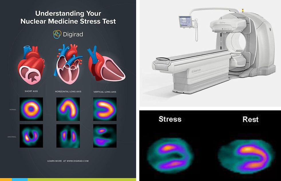 The patient is connected to an electrocardiogram (ECG), so the heart rhythm can be monitored by a physician or other medical