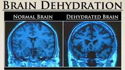 DehydratedBrain.jfif