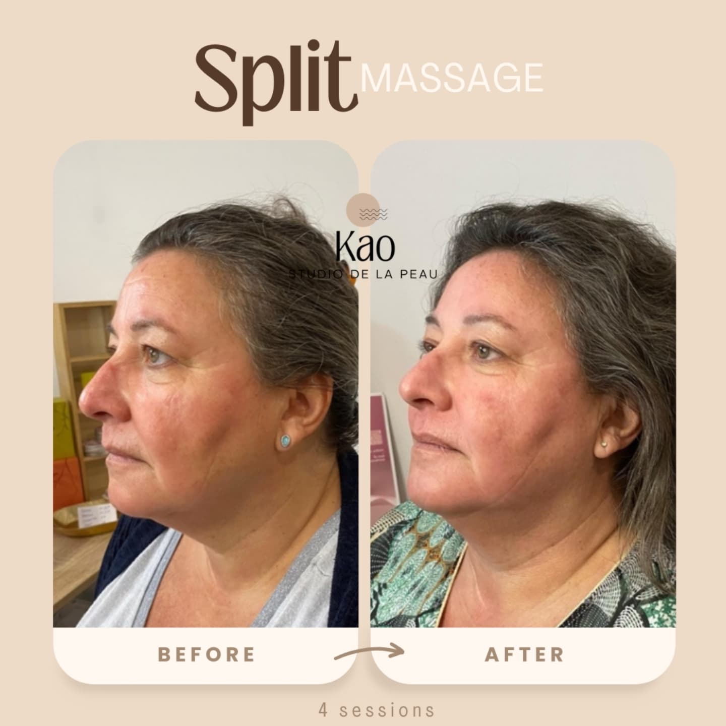 SPLIT MASSAGE A CAEN 50 ANS