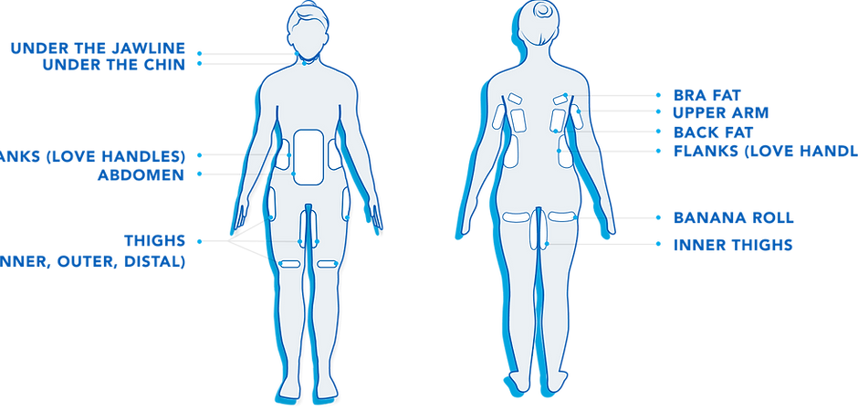 Female- Coolsculpting