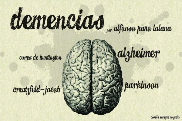 alz large.jpg