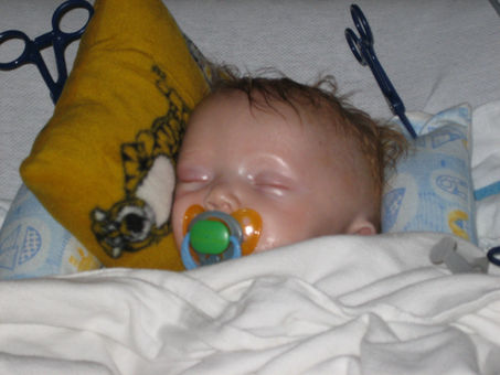 Surgery a success!!!