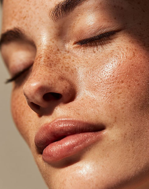 VENOM AND VELVET YYC CALGARY AESTHETIC STUDIO PRP BIOGEL