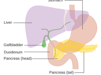 Adding high-dose vitamin C doubled survival for late stage pancreatic cancer patients
