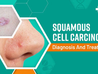 A topical combination therapy may prevent SCC, the second most common form of skin cancer