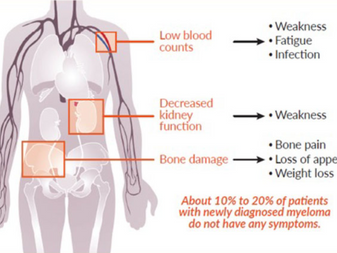 Signs and symptoms of multiple myeloma