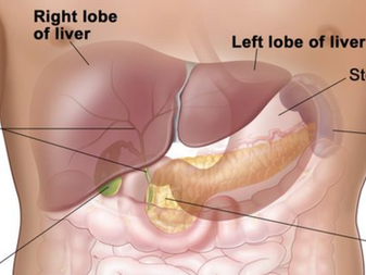 Liver cancer recurrence higher for patients with diabetes and/or obesity