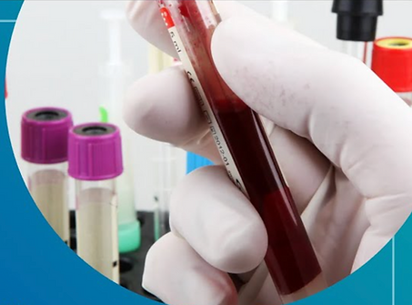A blood containing vial