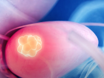 Combination treatment shows promise for rare, fatal cancersÂ