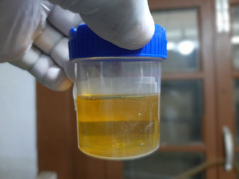 urine sample for testing