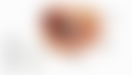 Dry Eye - It's More Common Than You Think!