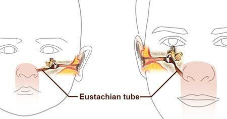 The Eustachian tube is changes position with age.