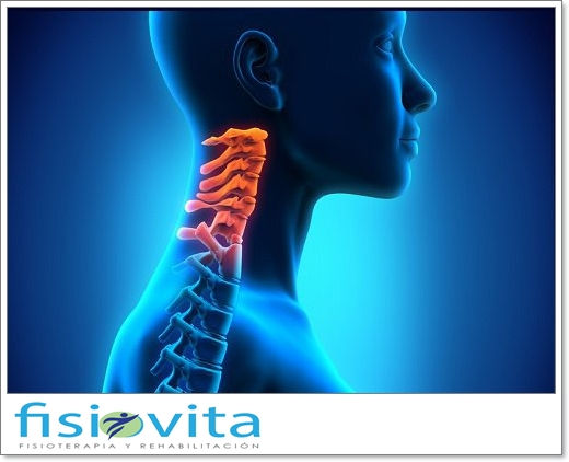 Cervicalgia