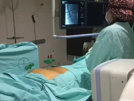 Vertebrocementoplastía