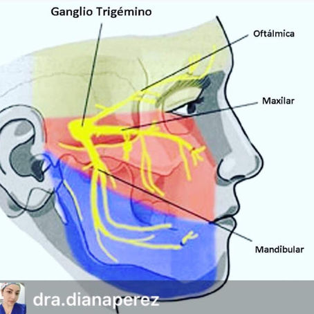 Neuralgia del Trigémino