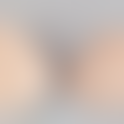 Breast Cancer and Prosthetics also known as breast forms: Know Your Options