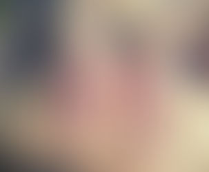 Pain Tolerance and Tissue Tolerance in Physiotherapy