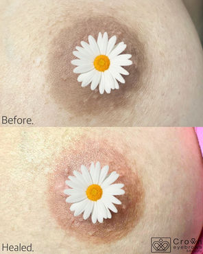 เรื่องที่คุณควรรู้ก่อนตัดสินใจสักนมชมพู