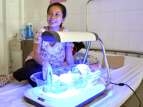 Newborn jaundice with yellowish skin treated using phototherapy lamp in Kuala Lumpur