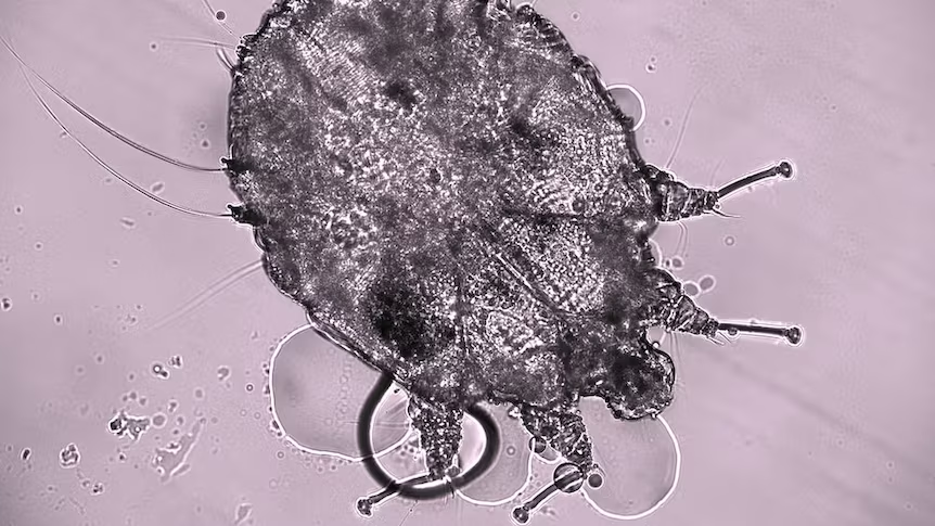 Mite infestation treatment in KL bedroom with steam machine