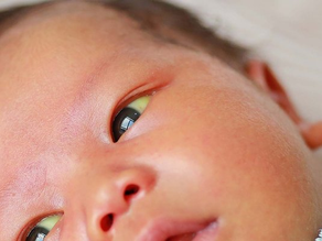 Hospital treatment for infant jaundice supported by lamp rental Kajang