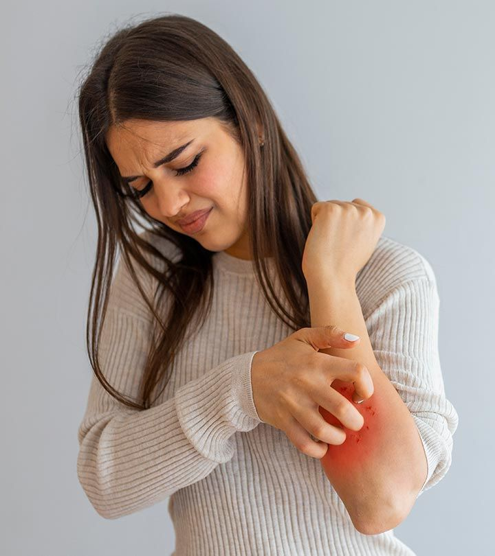 Warning signs of scabies infection on a human arm