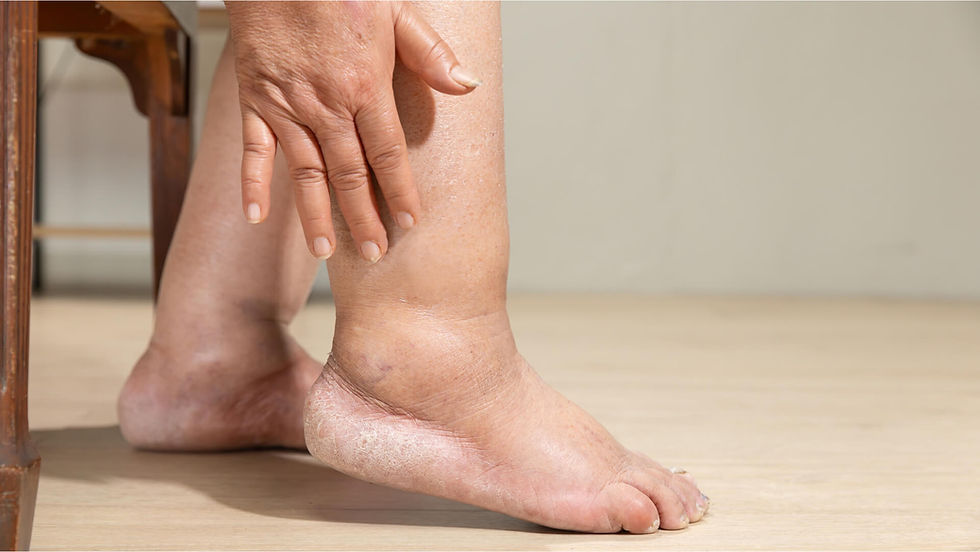 Peripheral Arterial Disease (PAD) .jpg