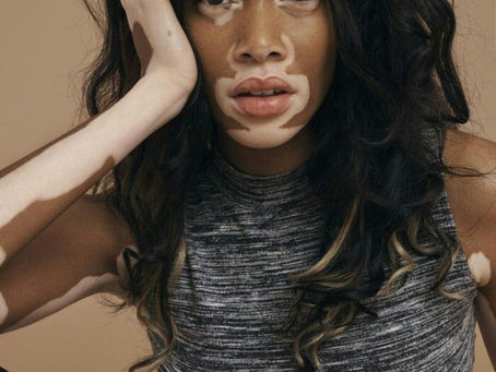 Ο ''αποδιοπομπαίος τράγος '' και το αβάσταχτο φορτίο του.