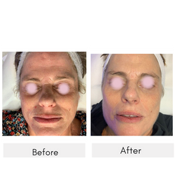 Clean Neutral Minimal Before After Learning Skincare Instagram Post