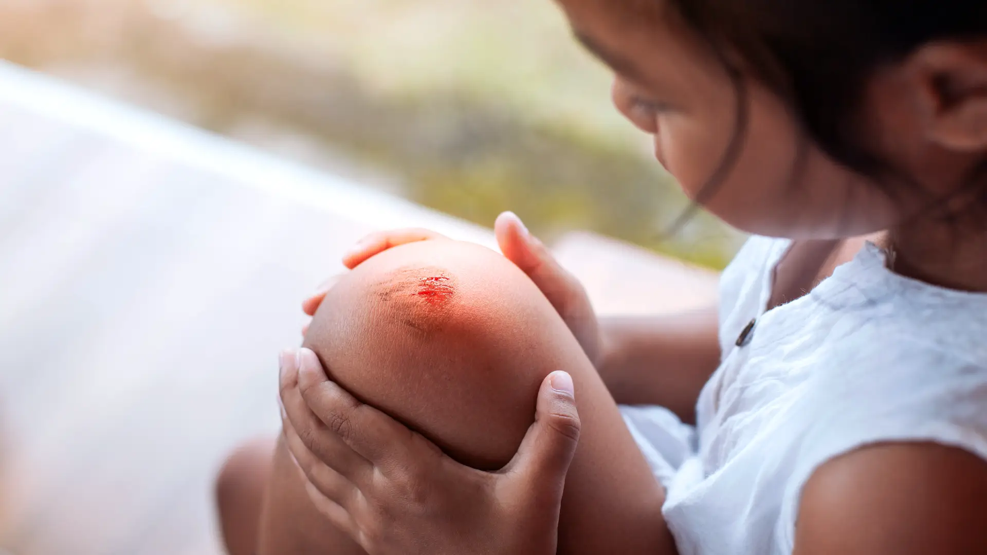 A little girl, 9 years old, wraps her hands delicately against her knee, which is clearly scrapped and bleeding.