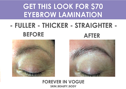 Before and After photo client 2.png