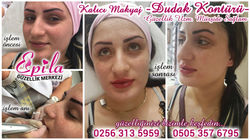 Epila-Güzellik-Dudak-02-