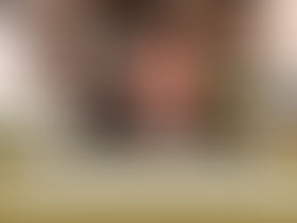【其他】男士脫髮除了植髮外,還有甚麼治療方法?