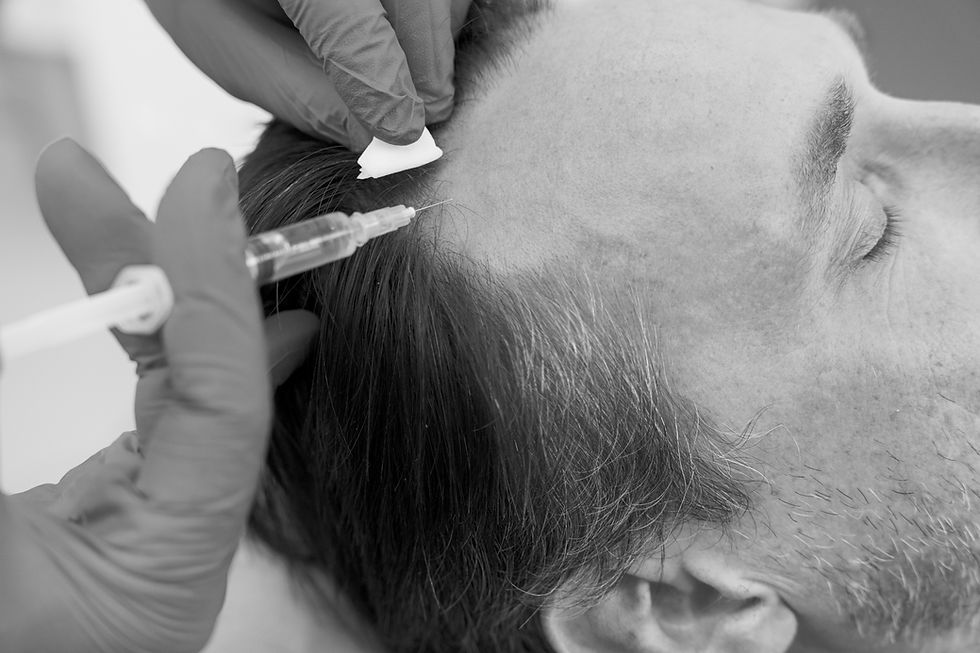 man-getting-hair-loss-treatment_edited.jpg