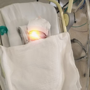 NICU - First Physiotherapy Session