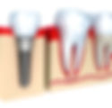 14.jpeg