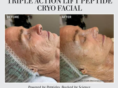 facial