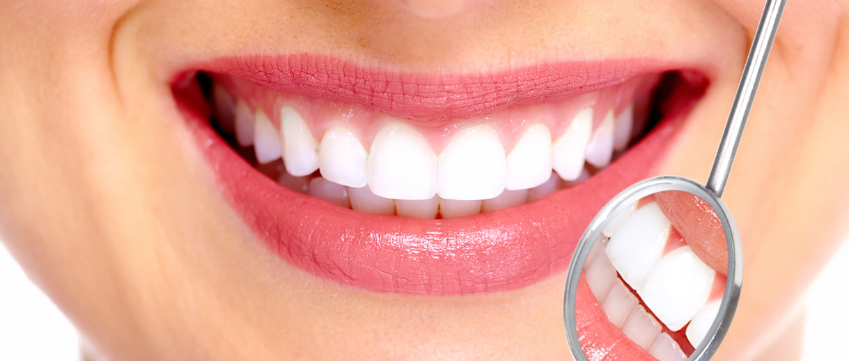 Perfect Smile