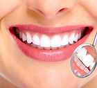 Bright white smile