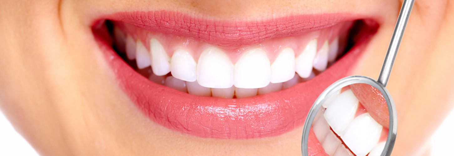 Perfect Smile