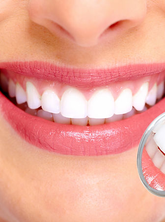 Perfect Smile