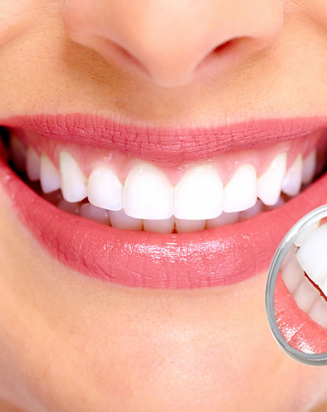 Perfect Smile